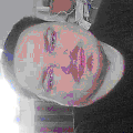 Photo - 1